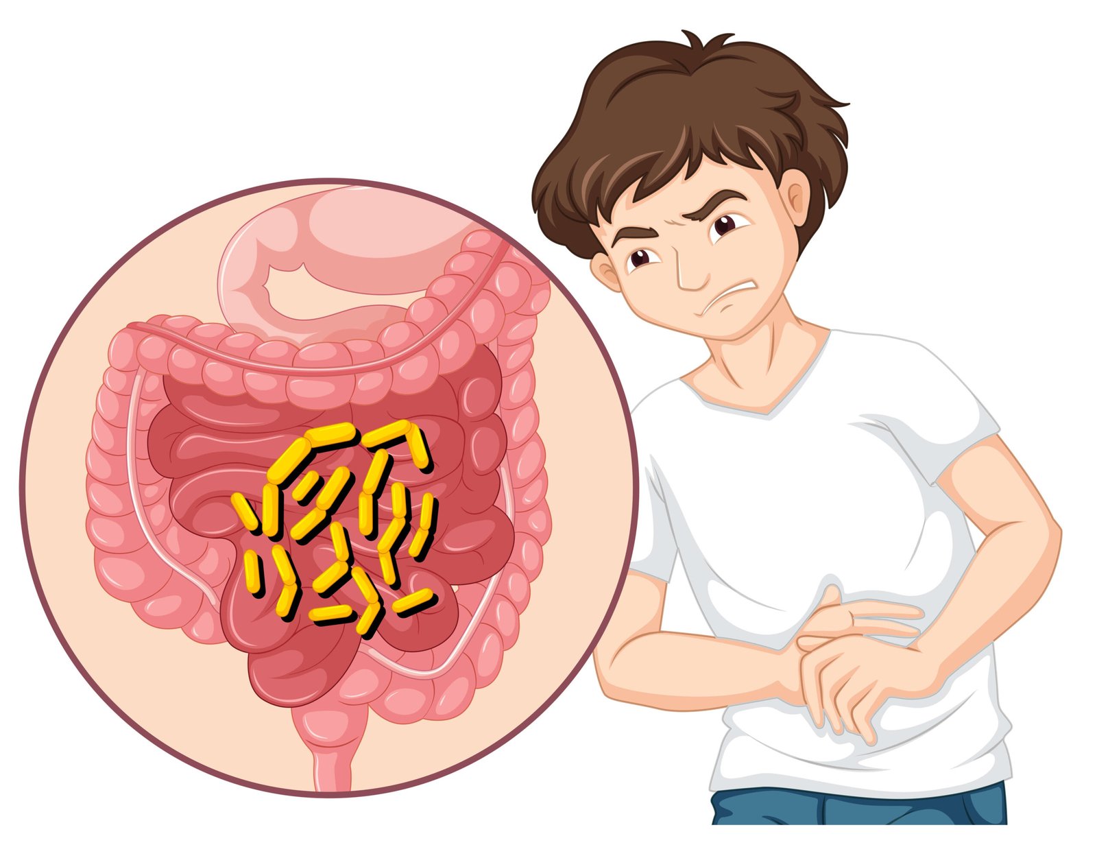 Ulcer Healing: Types, Stages, Treatments, and Remedies